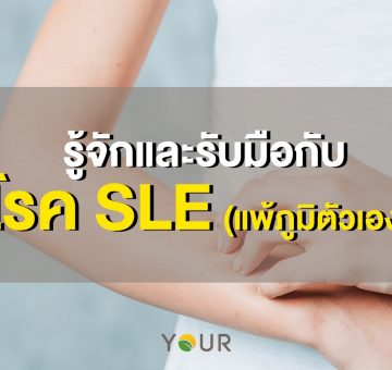 แพ้ภูมิตัวเอง SLE
