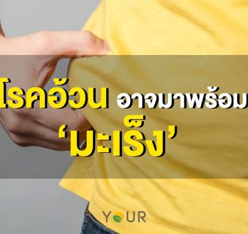 โรคอ้วน