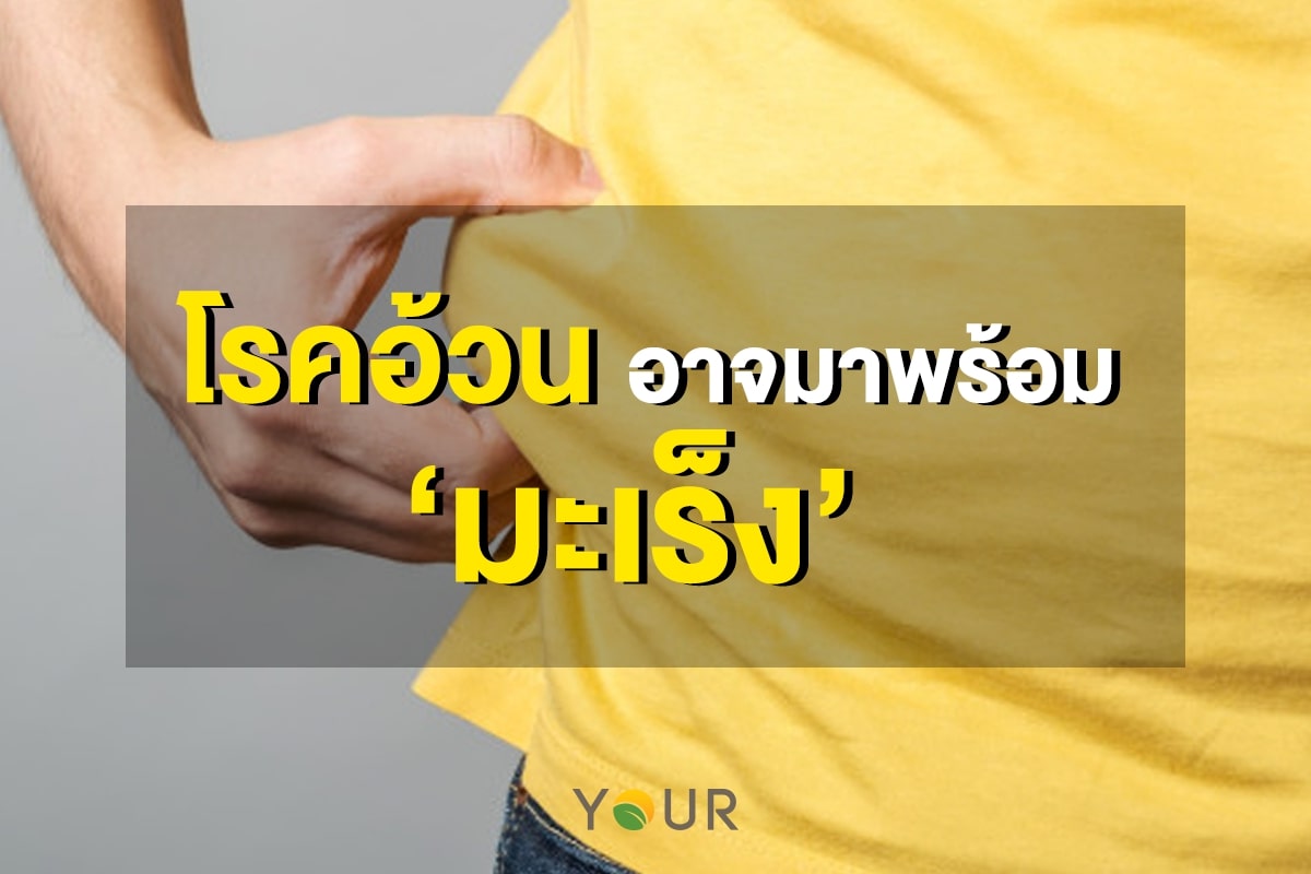 โรคอ้วน