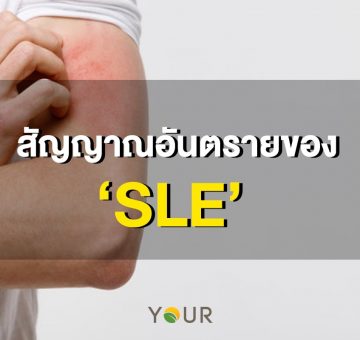 โรคแพ้ภูมิตัวเอง