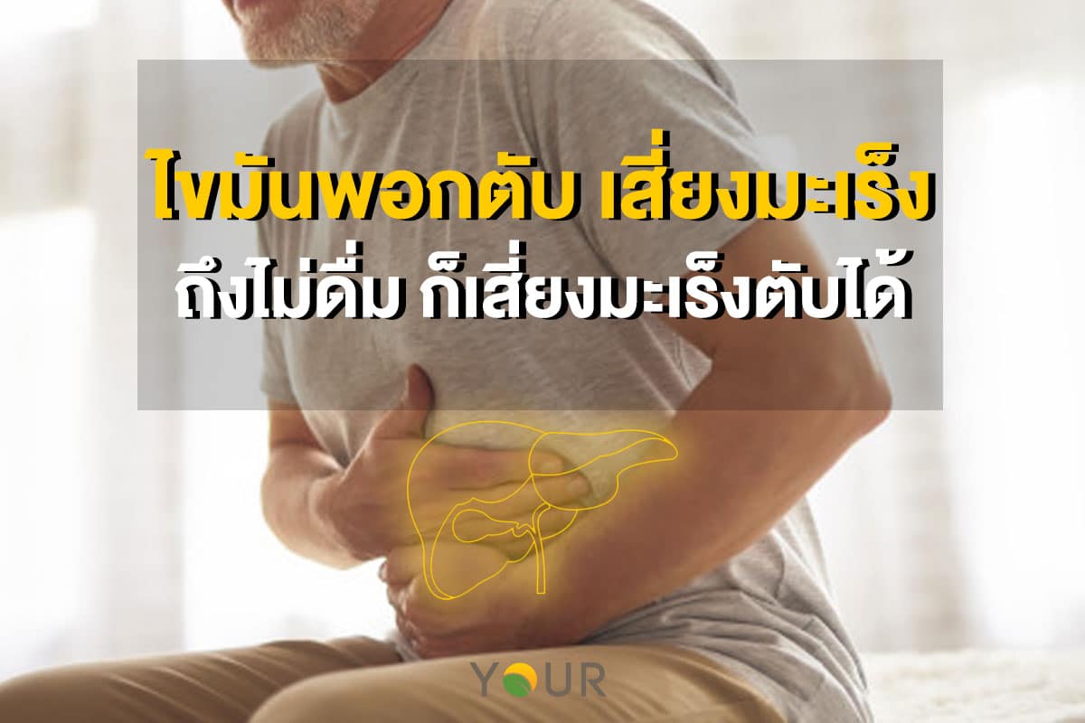 ไขมันพอกตับ