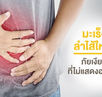มะเร็งลำไส้