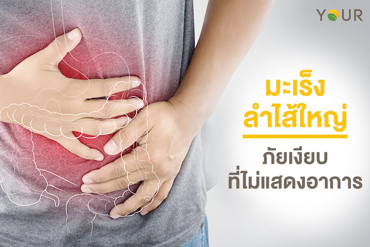 มะเร็งลำไส้