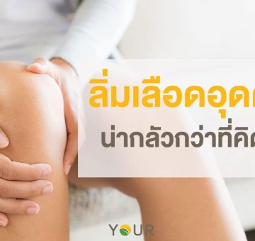 ลิ่มเลือดอุดตัน