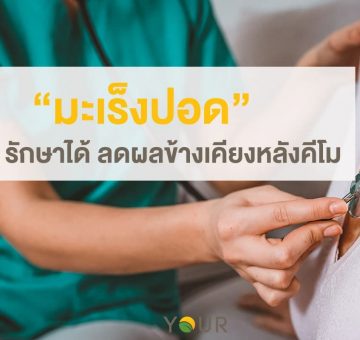 มะเร็งปอด