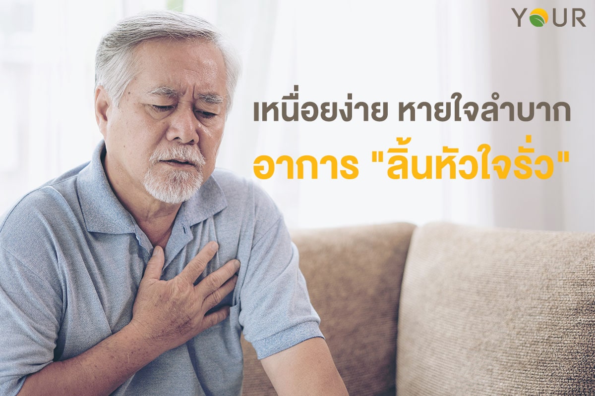 ลิ้นหัวใจรั่ว