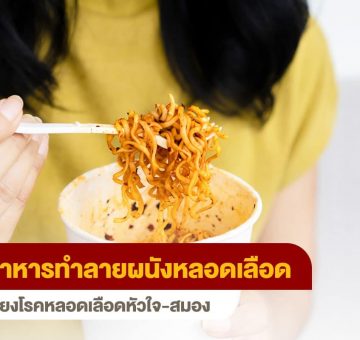 ผนังหลอดเลือด