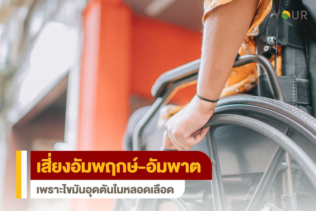 อัมพฤกษ์