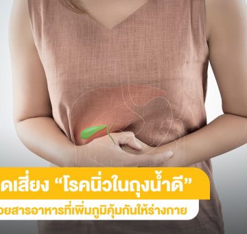 โรคนิ่วในถุงน้ำดี
