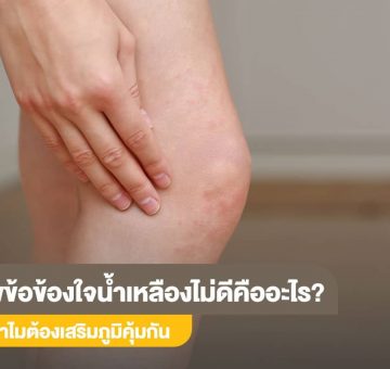 น้ำเหลืองไม่ดี