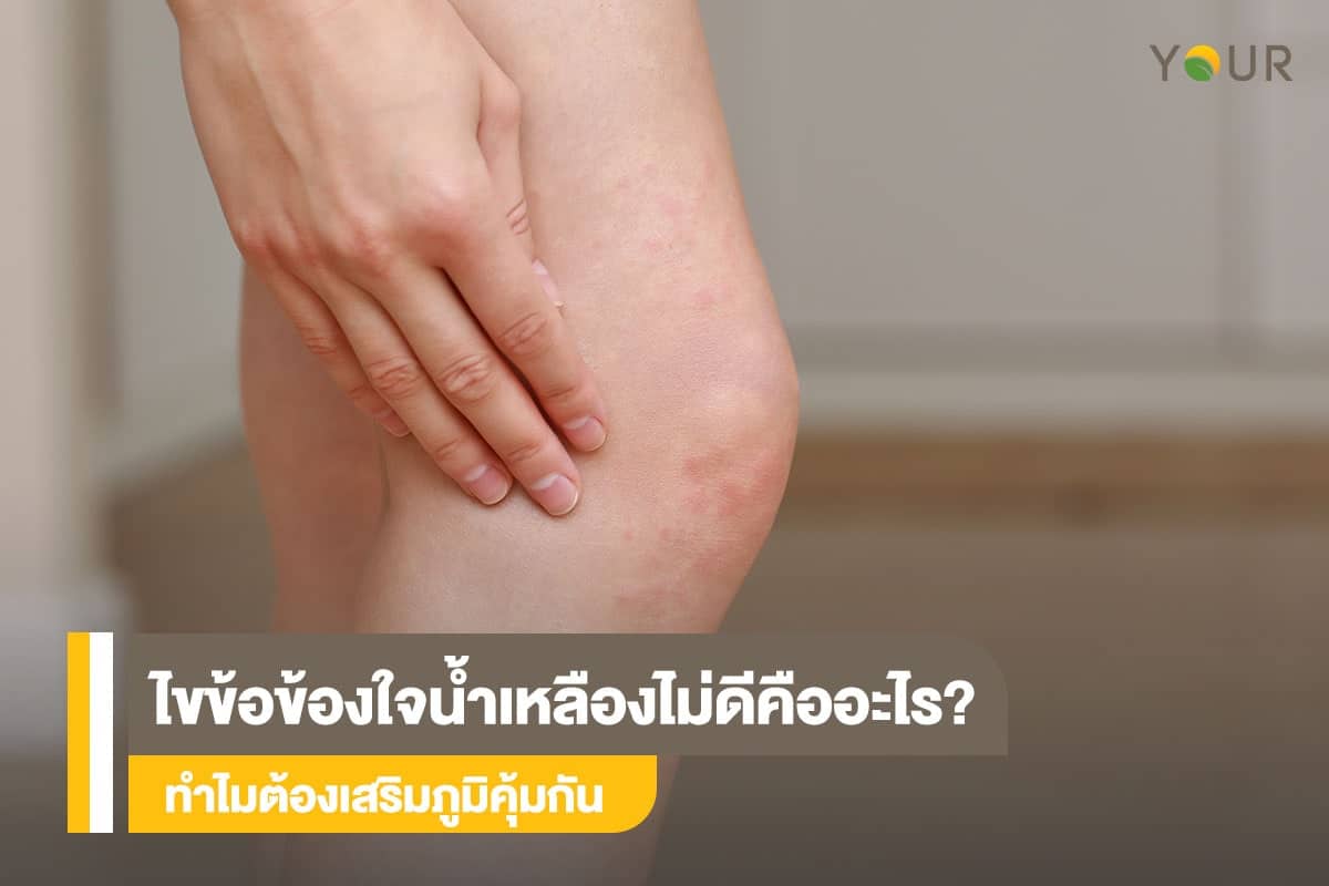 น้ำเหลืองไม่ดี