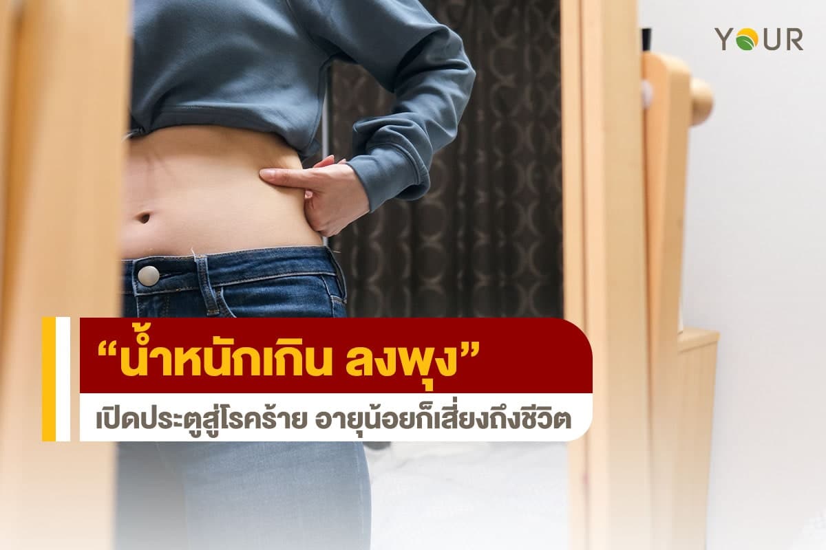 น้ำหนักเกิน