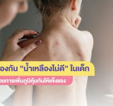 น้ำเหลืองไม่ดี