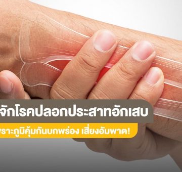 โรคปลอกประสาทอักเสบ