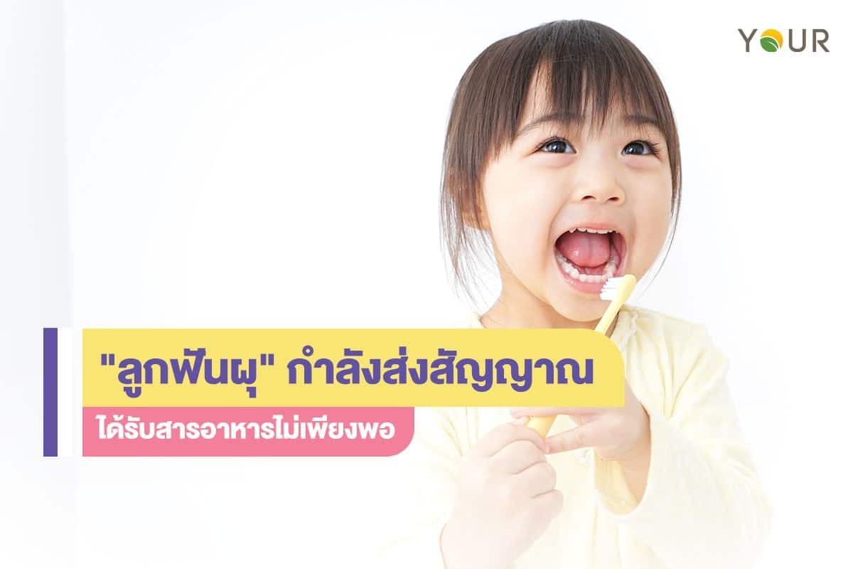 ลูกฟันผุ