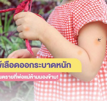 ไข้เลือดออก