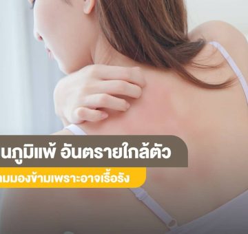 ผื่นภูมิแพ้
