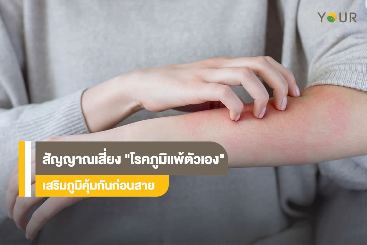 โรคภูมิแพ้ตัวเอง