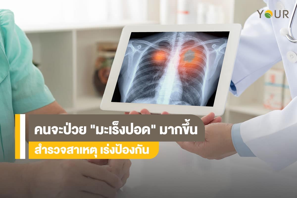 มะเร็งปอด