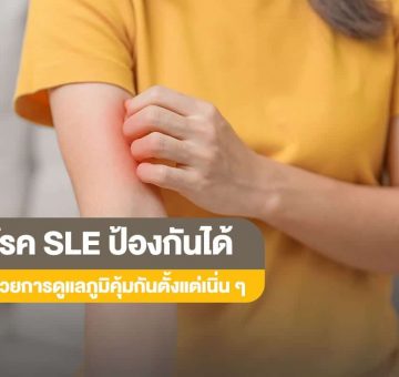 โรค SLE
