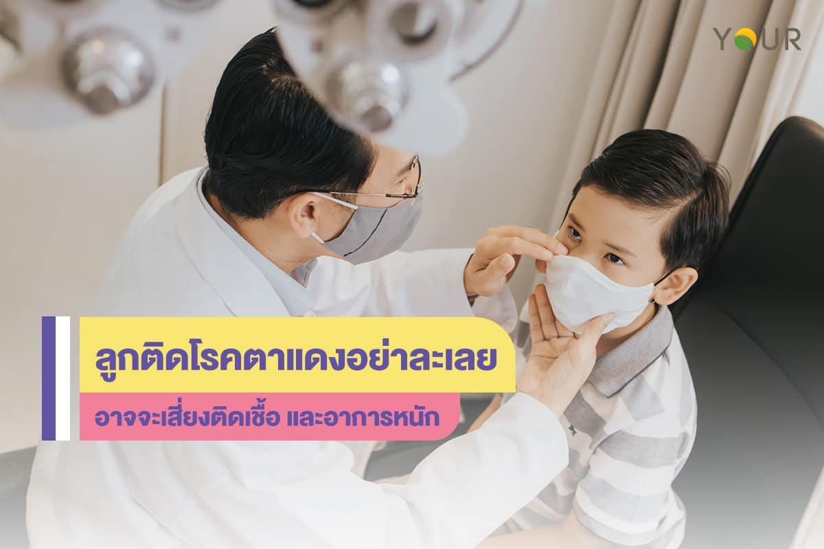 โรคตาแดง