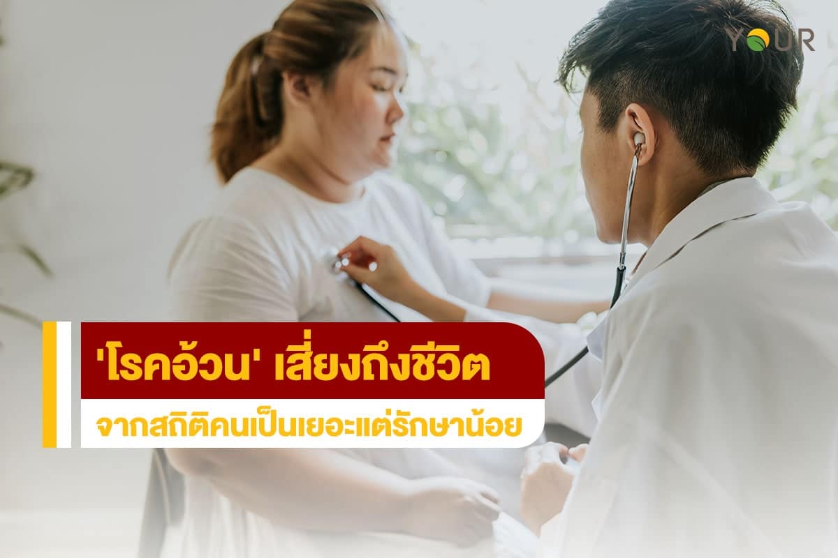 โรคอ้วน