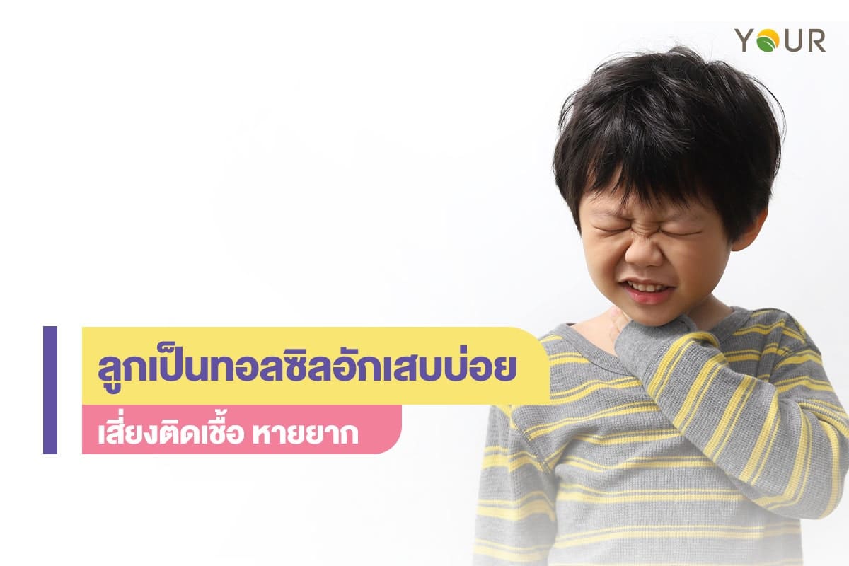 ทอลซิลอักเสบ