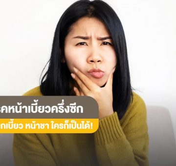 โรคหน้าเบี้ยวครึ่งซีก