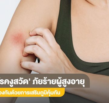 โรคงูสวัด